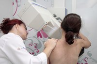 Comissão aprova realização de mamografia em todas as mulheres