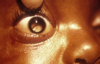 Reflexo incomum nos olhos pode ser  alerta para câncer
