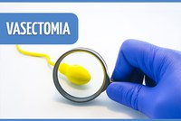 Cirurgia para quem não quer ter filhos