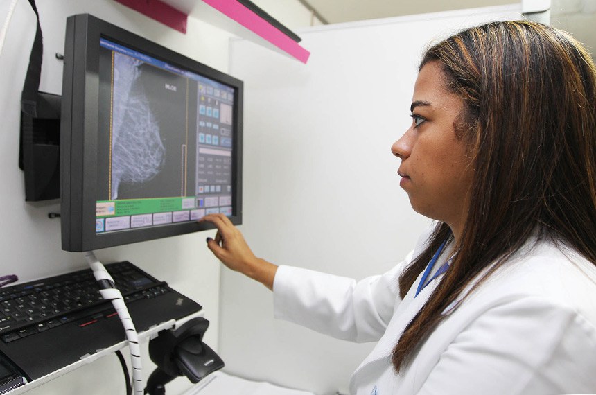 Mamografia em Salvador: mulher deve fazer exame a partir dos 40 anos 