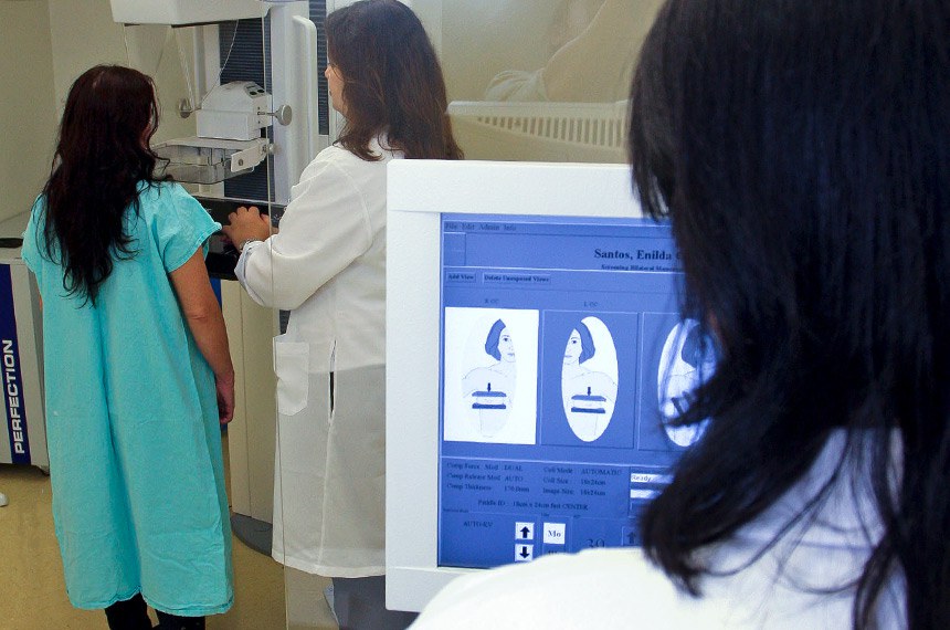 Mutirão da mamografia em São Paulo: o exame deve ser realizado anualmente, depois que a mulher completar 40 anos 