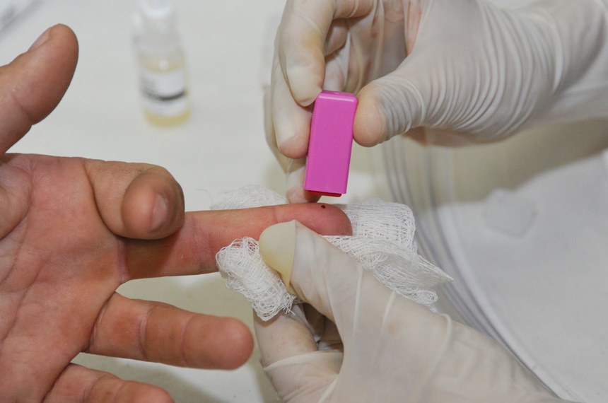 Detecção do HIV é feita por exame de sangue: campanha mobiliza país