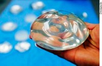 CAS realiza audiência pública sobre implantes de silicone e saúde da mama