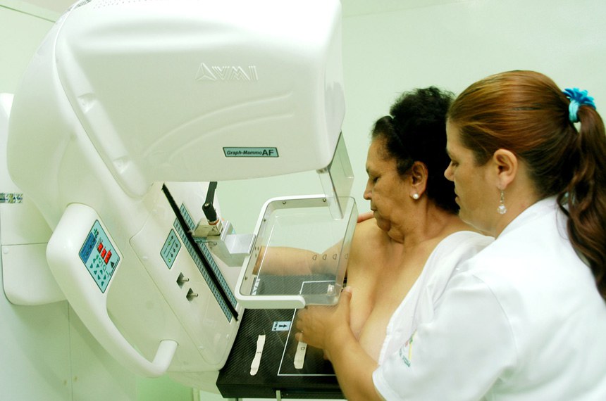 Idade ideal para mamografia é tema de polêmica e de vários projetos em  tramitação — Senado Notícias