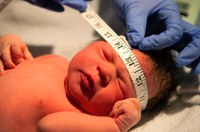 Desenvolvimento de crianças com microcefalia será tema de palestra