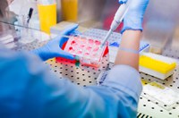 Randolfe entra com ações contra falta de testes de genotipagem de HIV no SUS