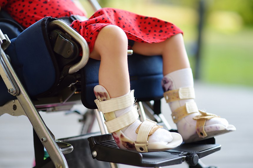 Disabled girl sitting in wheelchair. On her legs orthosis. Close up photo. Child cerebral palsy. Disability. Inclusion. Family with disabled kid.