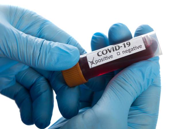 Coronavirus COVID-19 Blood Sample
